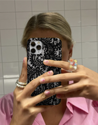 Lüks Dantel Görünümlü Premium Telefon Kılıfı